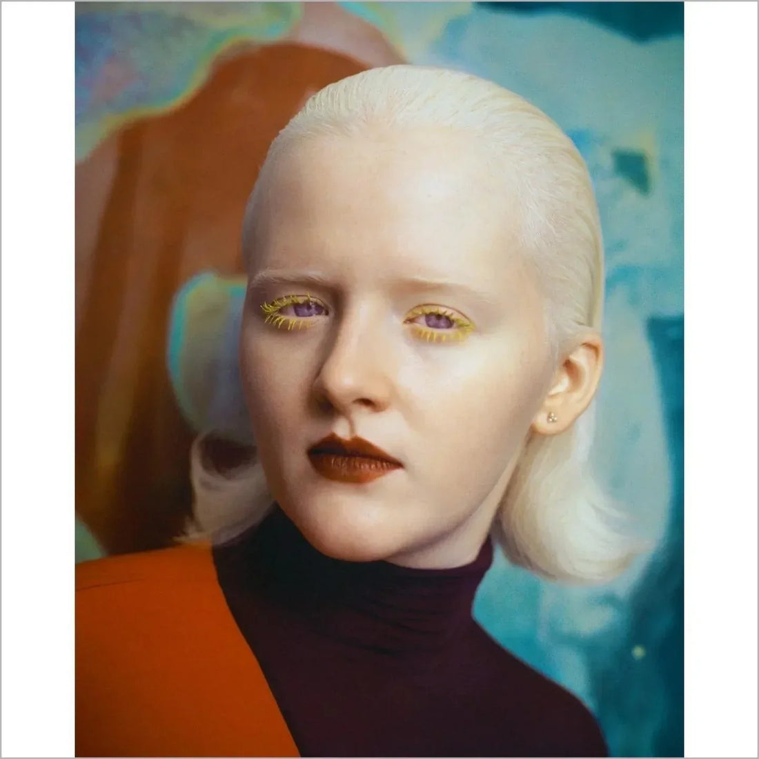 ALLURE